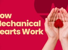 Human Heart Beats with the Help of a Machine: How Mechanical Hearts Work How Mechanical Hearts Work