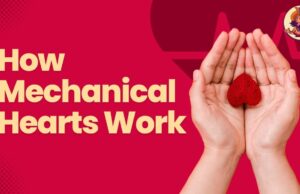 Human Heart Beats with the Help of a Machine: How Mechanical Hearts Work How Mechanical Hearts Work